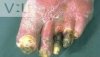 nasty_zps17bbc00f.jpg
