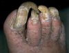 uglyfeet.jpg